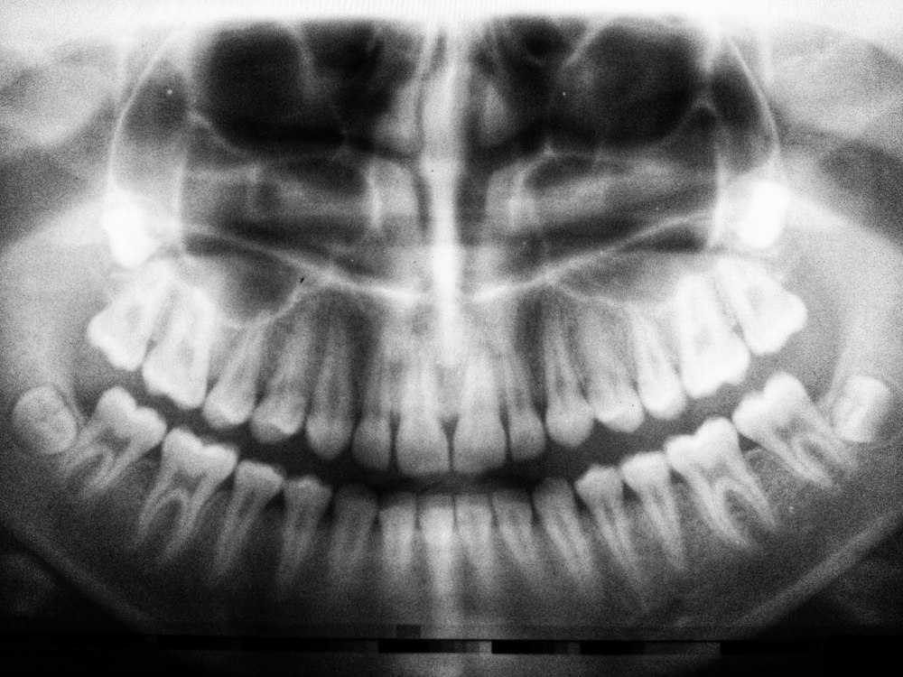 Radiografia panorâmica odontológica analisada por IA